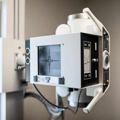 Chiropractic Columbus OH X-Ray Machine Chiropractic Columbus OH X-Ray Machine